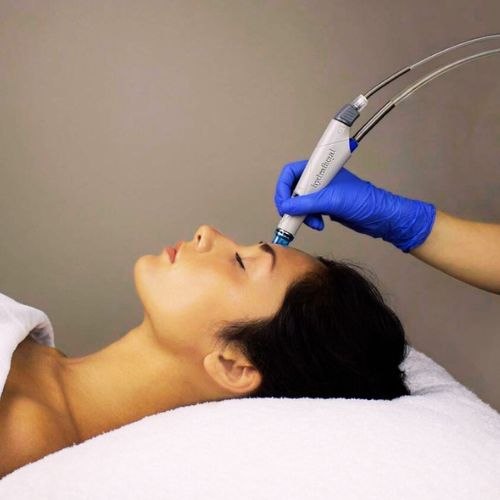 hydrafacial à Lille - le soin du visage pour nettoyer la peau en profondeur