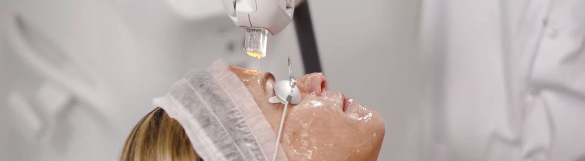 Lumière pulsée IPL pour le rajeunissement du visage à Lille